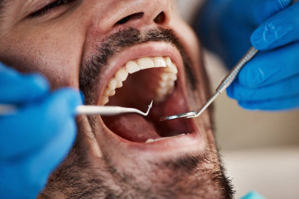 Professional Emergency Dentist in IA